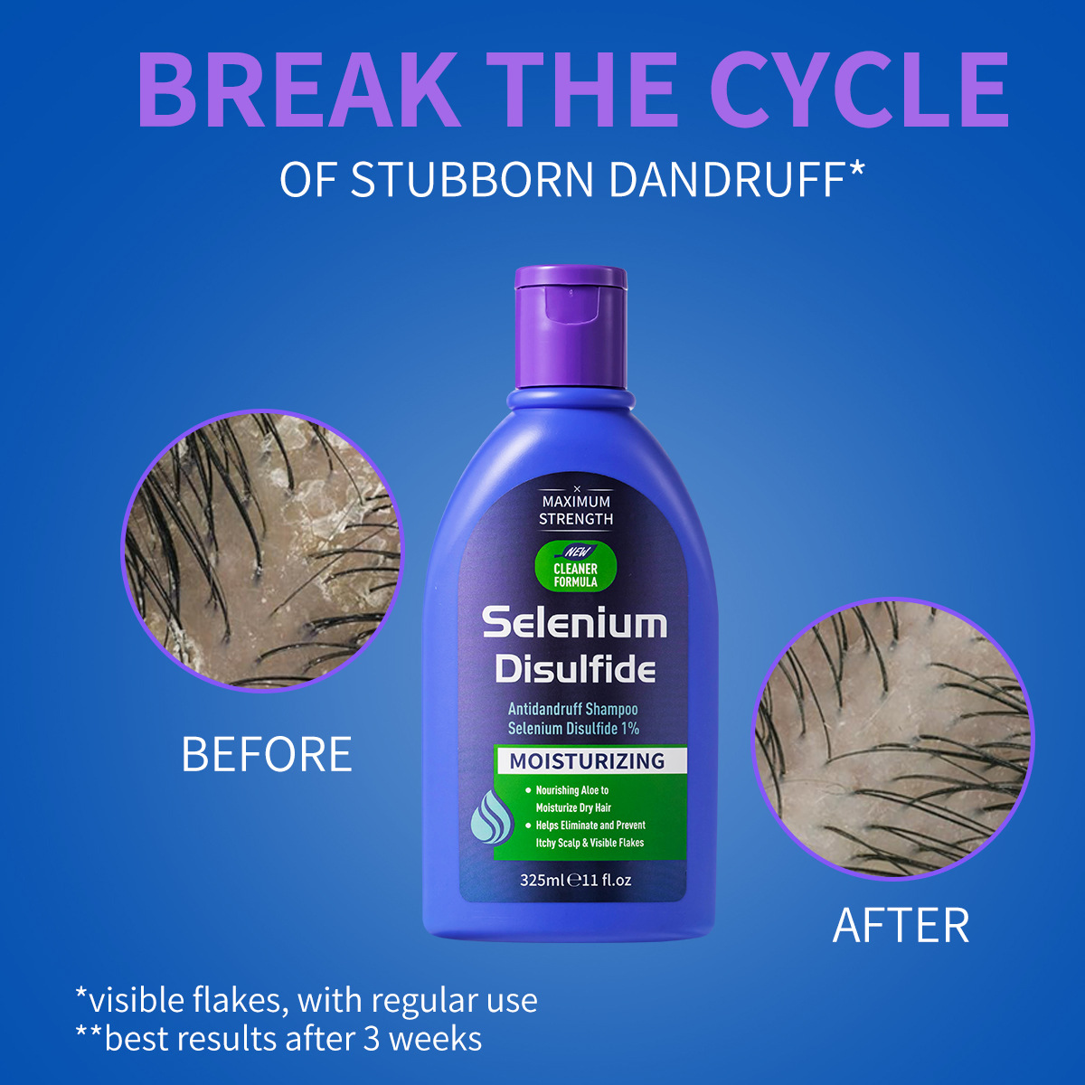 325ml Selenium Disulfide Anti  - огляд і ціна Hair Care Dandruff
